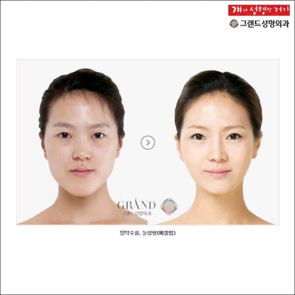 �؍��̐��`�r�t�H�[�E�A�t�^�[